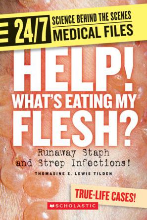 Help! What's Eating My Flesh?